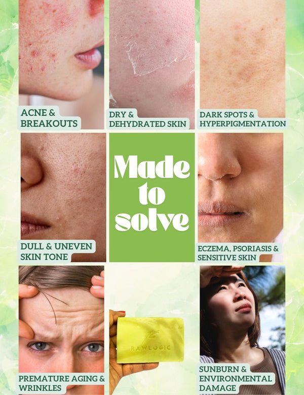 Moringa Aloe Clarifying Soap helps reduce acne, dark spots, dryness, and dull skin for a healthier complexion