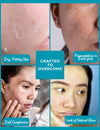 Targets dry skin, pigmentation, and dullness – Rose Luxe Bar