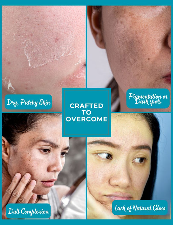 Targets dry skin, pigmentation, and dullness – Rose Luxe Bar