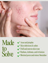 Herbal Soap for Acne-Prone and Oily Skin – Natural Ayurvedic Cleanser