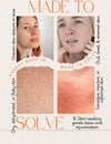 Soap to Heal Pigmentation, Sun Damage & Skin Sensitivity