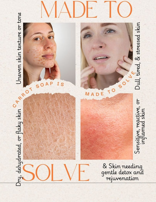 Soap to Heal Pigmentation, Sun Damage & Skin Sensitivity
